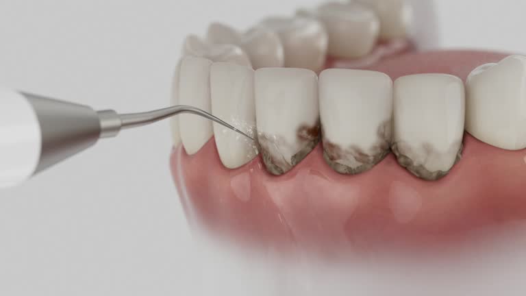 Trusted Wisdom Tooth Removal service in Bangs, TX - Dentist Open Now